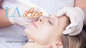 Woman receiving Actinic Keratosis Removal Treatment Great Barr