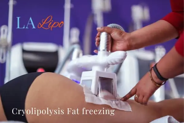 women getting fat freezing Great Barr