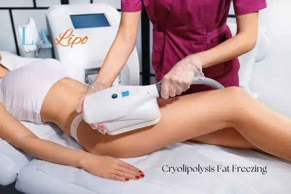 Woman receiving coolsculpting Great Barr treatment on her thighs