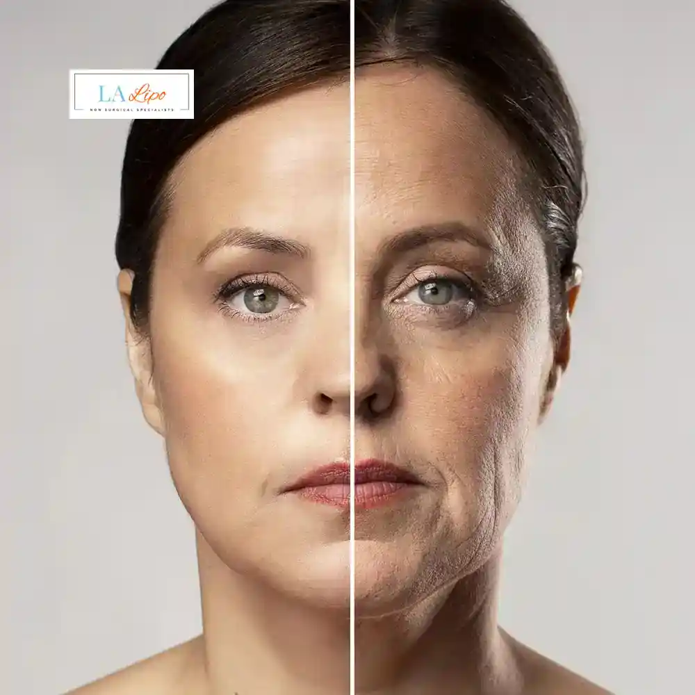 How Can You Tell If Non-Surgical Skin Tightening Is Right for You Great Barr?