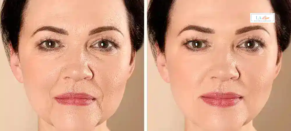 Why Aren’t My Skincare Products Making My Sagging Skin Look Firmer Great Barr?