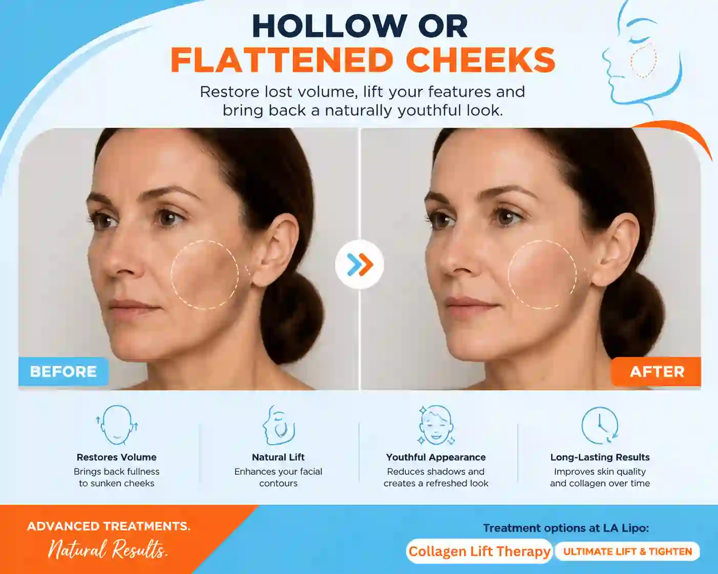 Sign #4: Hollow or Flattened Cheeks Great Barr