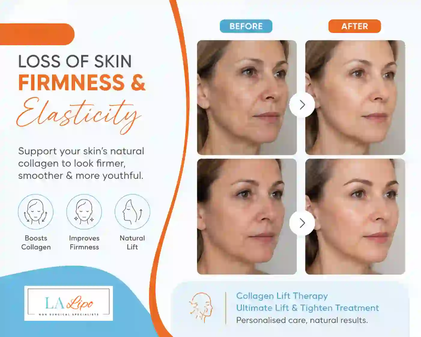 Sign #7: Loss of Skin Firmness and Elasticity Great Barr